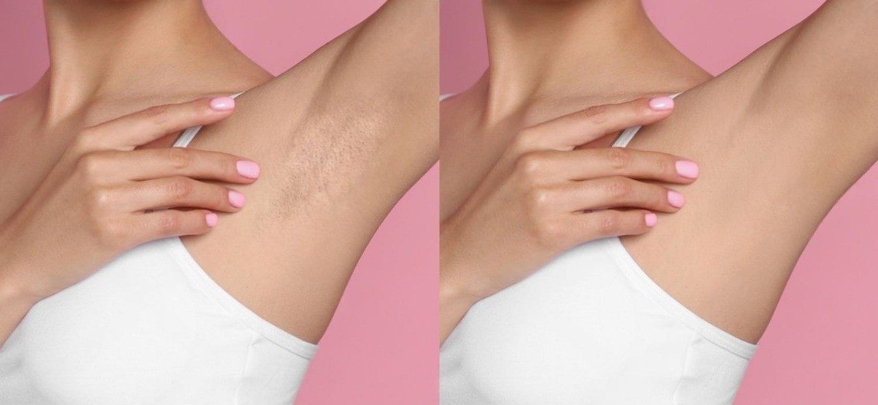 DeWatermark.ai 1753847859643